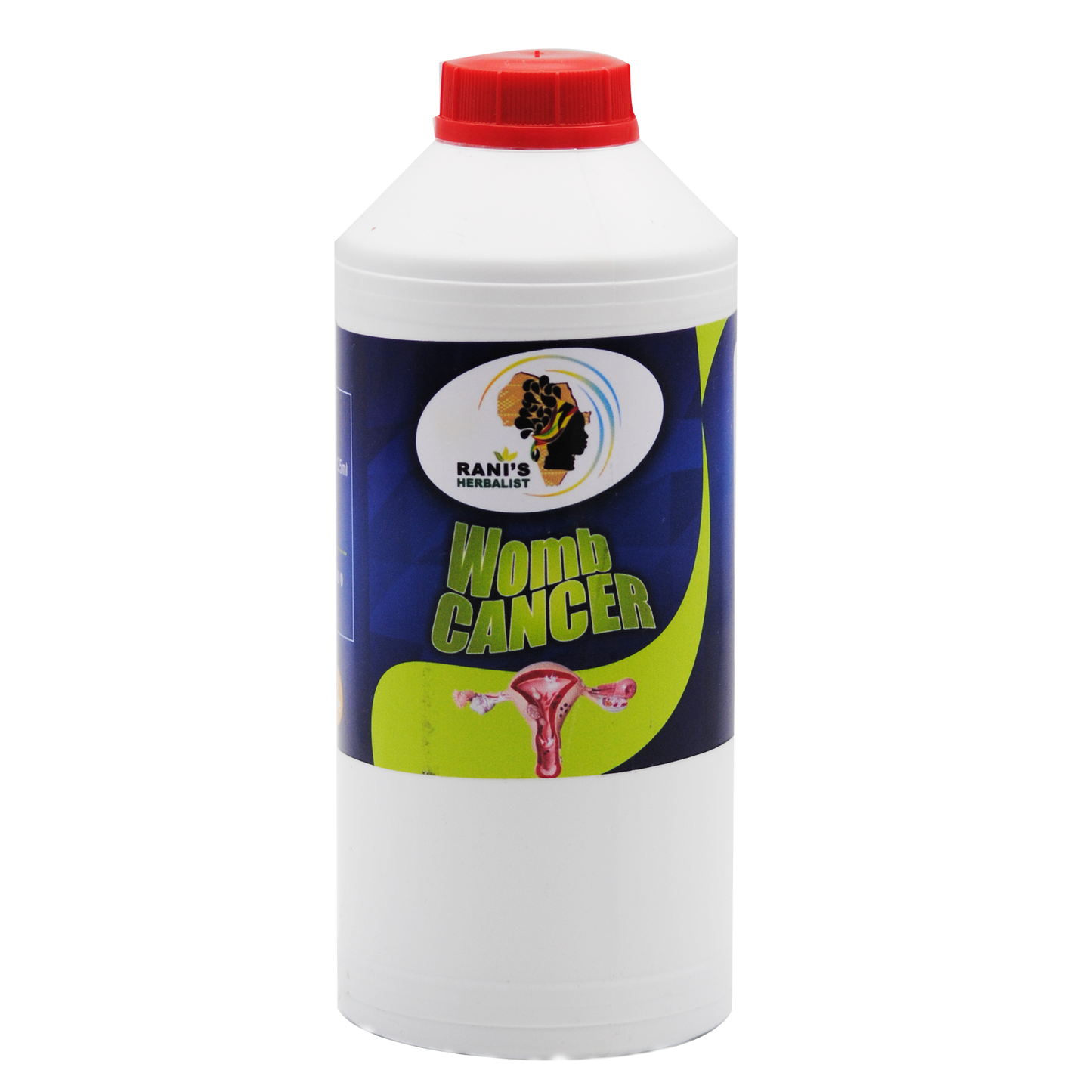 Womb Cancer 1L